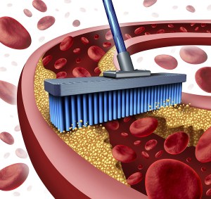 Recovery Blood Clot Filter in Tennessee