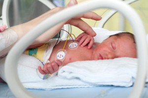 Birth Injury Risks for Premature Infants